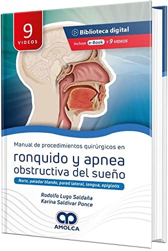 Manual de Procedimientos Quirúrgicos en Ronquido y Apnea Obstructiva del Sueño. Nariz, Paladar Blando, Pared Lateral, Lengua, Epiglotis