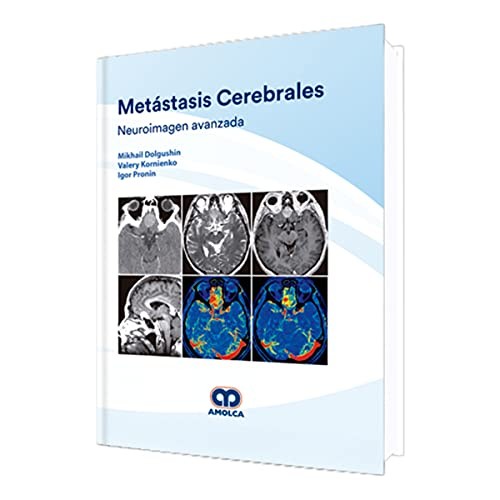 Metástasis Cerebrales
