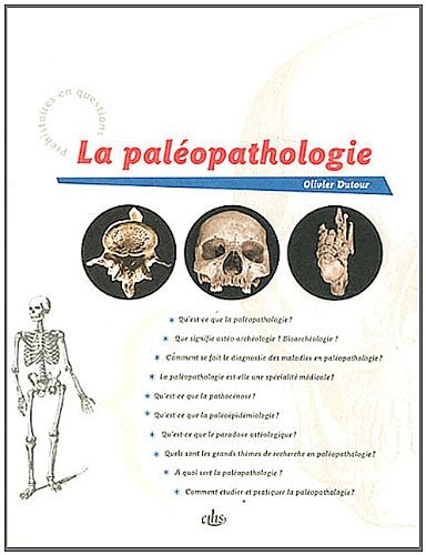 La paléopathologie