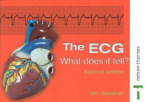 The ECG
