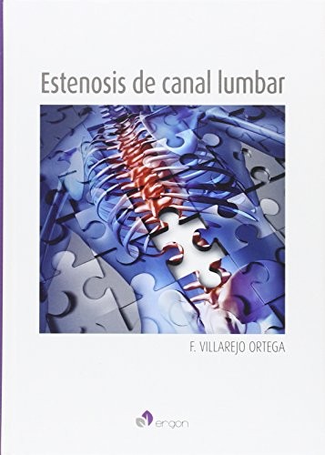 Estenosis del canal lumbar