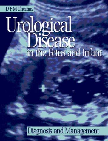 Urological disease in the fetus and infant