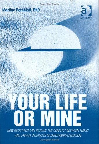 Your life or mine