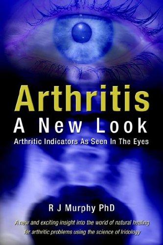 Arthritis, a New Look