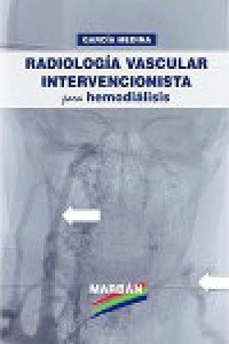 Radiología vascular intervencionista para hemodiálisis