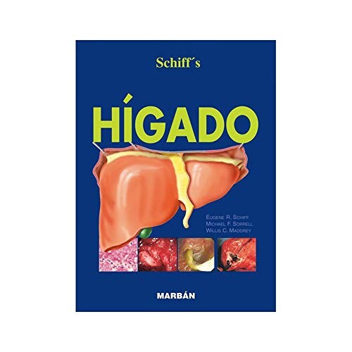 HÍGADO T.D. Gran Formato Ó