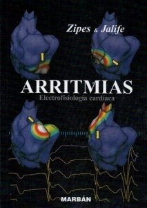 ARRITMIAS