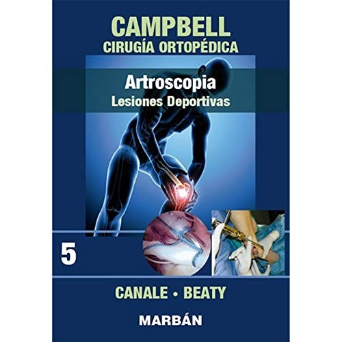ARTROSCOPIA. LESIONES DEPORTIVAS