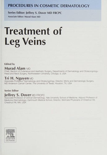 Treatment of leg veins