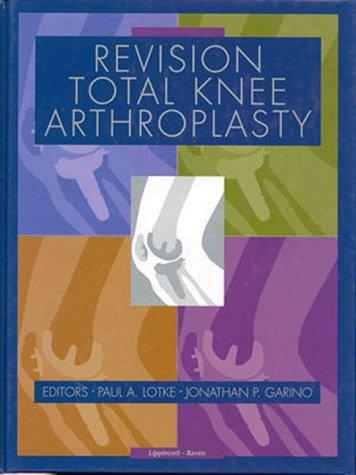 Revision total knee arthroplasty