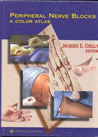 Peripheral Nerve Blocks