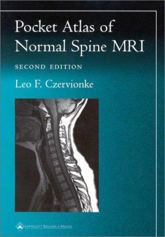 Pocket Atlas of Spinal MRI (Radiology Pocket Atlas Series)