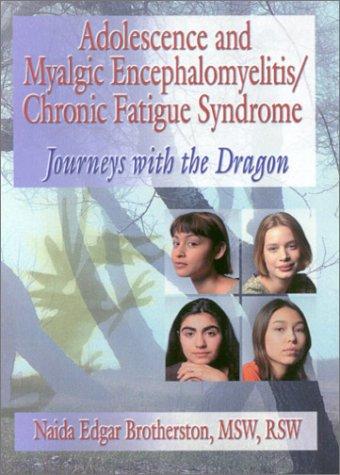 Adolescence and Myalgic Encephalomyelitis/Chronic Fatigue Syndrome