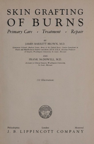Skin grafting of burns