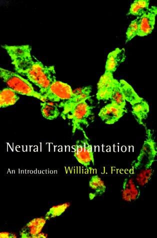 Neural Transplantation
