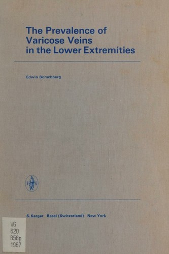 The prevalence of varicose veins in the lower extremities