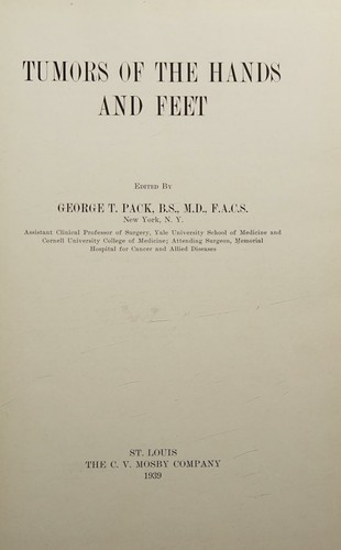 Tumors of the Hands & Feet
