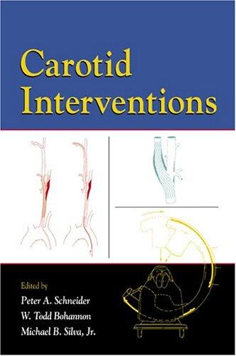 Carotid interventions