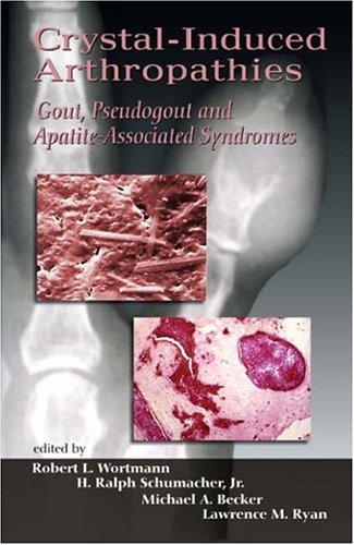 Crystal-induced arthropathies