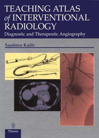 Teaching Atlas of Interventional Radiology