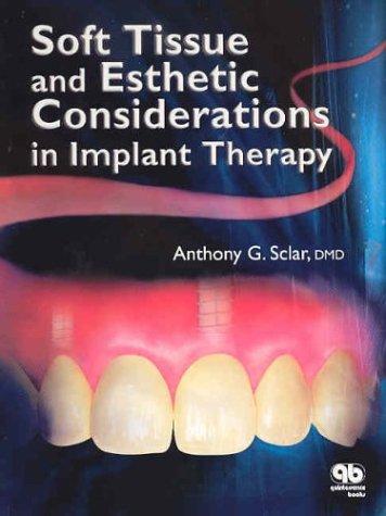 Soft Tissue and Esthetic Considerations in Implant Dentistry