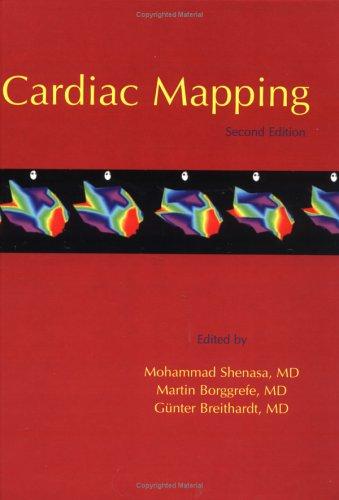 Cardiac mapping