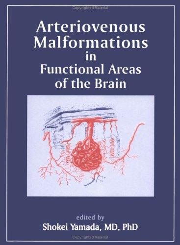 Arteriovenous malformations in functional areas of the brain