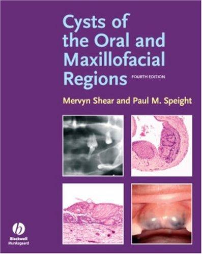 Cysts of the oral and maxillofacial regions