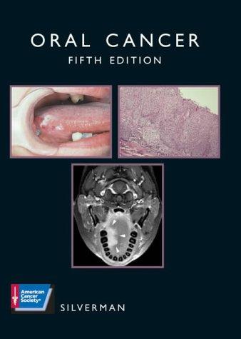 Oral cancer