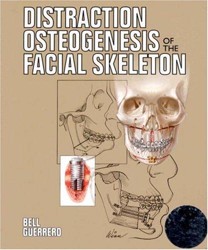 Distraction osteogenesis of the facial skeleton