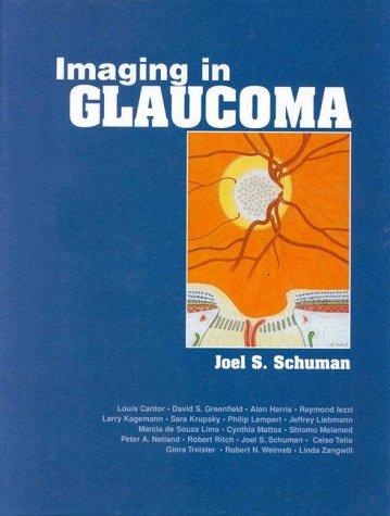 Imaging in glaucoma
