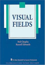 Visual fields