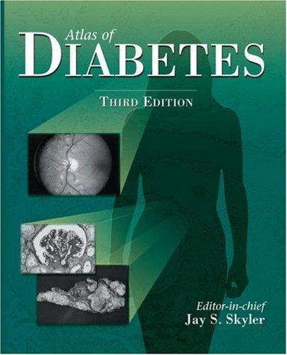 Atlas of diabetes