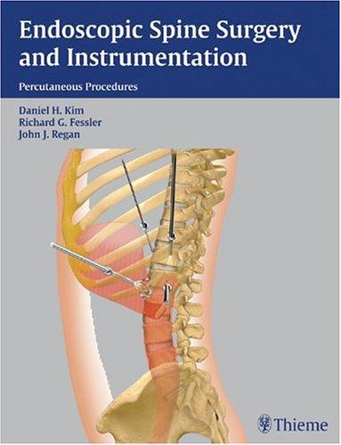 Endoscopic spine surgery and instrumentation