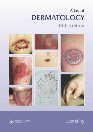 Atlas of Dermatology