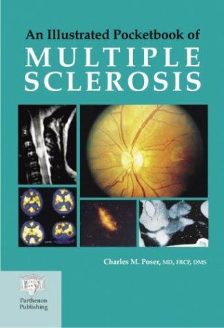 An illustrated pocketbook of multiple sclerosis