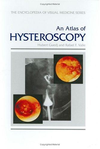 An atlas of hysteroscopy