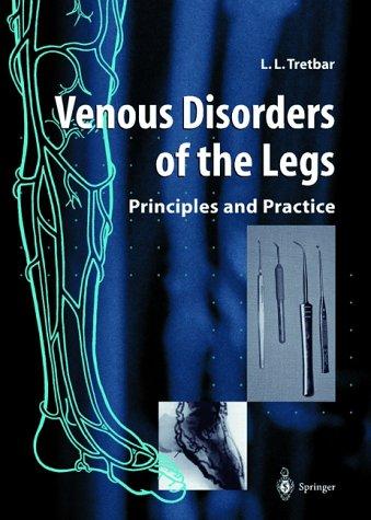 Venous disorders of the legs
