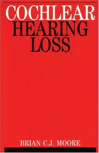 Cochlear Hearing Loss