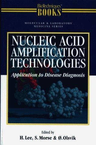 Nucleic acid amplification technologies