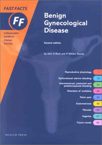 Fast Facts Benign Gynaecological Disease