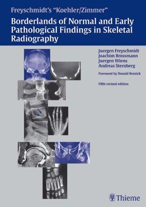 Borderlands of the normal and early pathologic findings in skeletal radiography