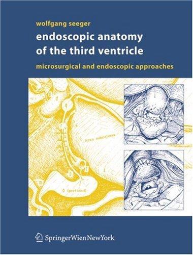 Endoscopic anatomy of the third ventricle