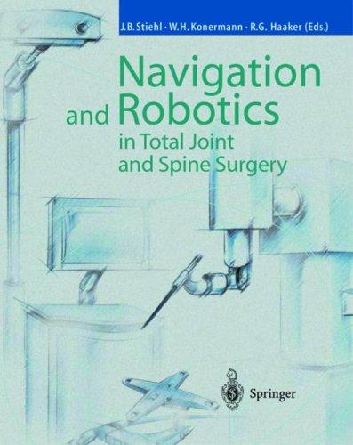 Navigation and robotics in total joint and spine surgery
