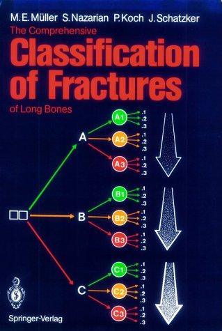 The comprehensive classification of fractures of long bones