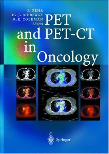 PET and PET-CT in oncology