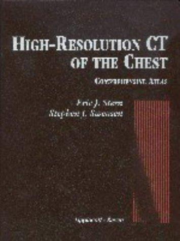 High-resolution CT of the chest