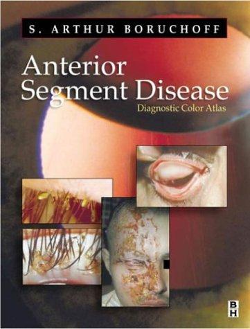 Anterior Segment Disease
