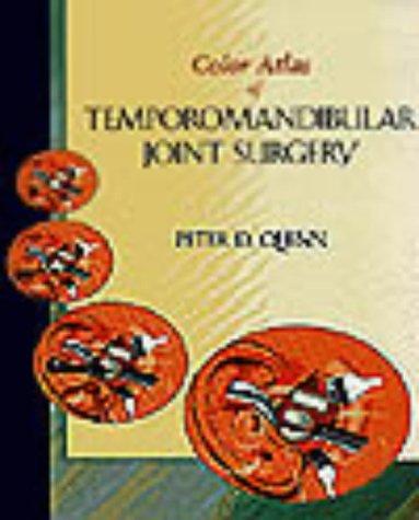 Color Atlas Of Temporomandibular Joint Surgery