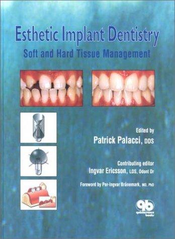 Esthetic Implant Dentistry